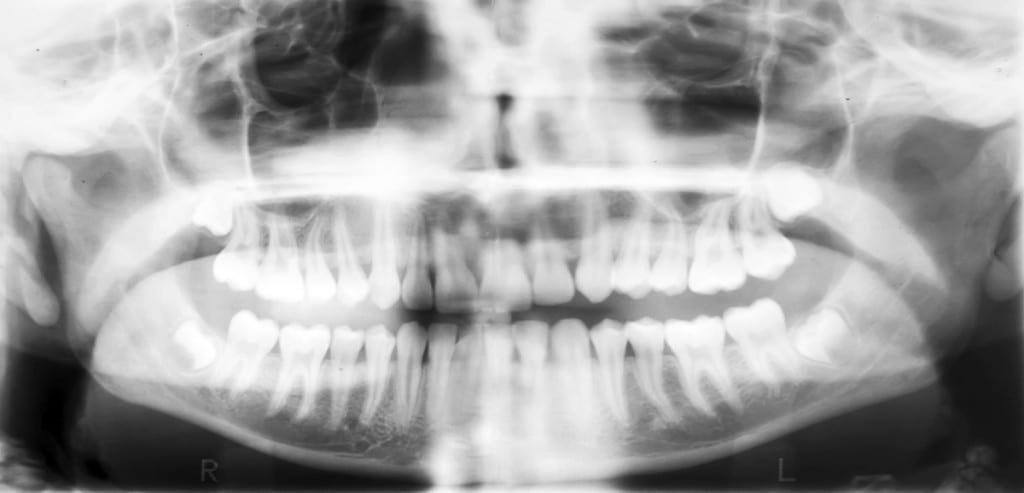 X-ray-of-the-oral-cavity